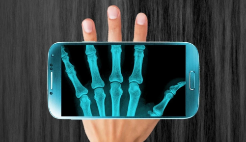 ֻ(Xray Hand Scanner Prank)