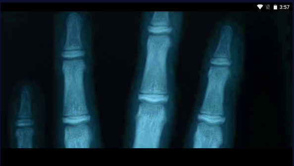 ֻ(Xray Hand Scanner Prank)