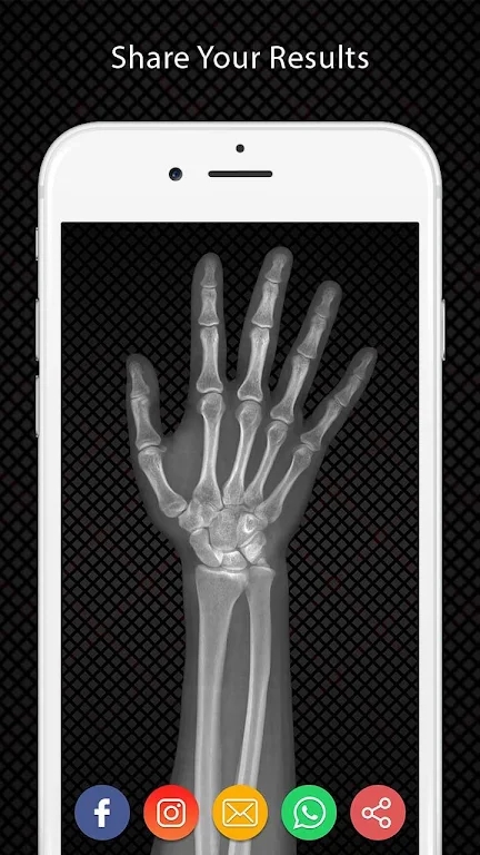 ֻ(Xray Hand Scanner Prank)v1.0 ׿İͼ0