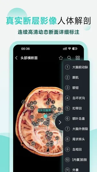 3D(3Dѧ)