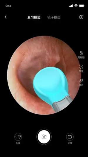 bebird采耳(采耳手机软件) bebird采耳(采耳手机软件)